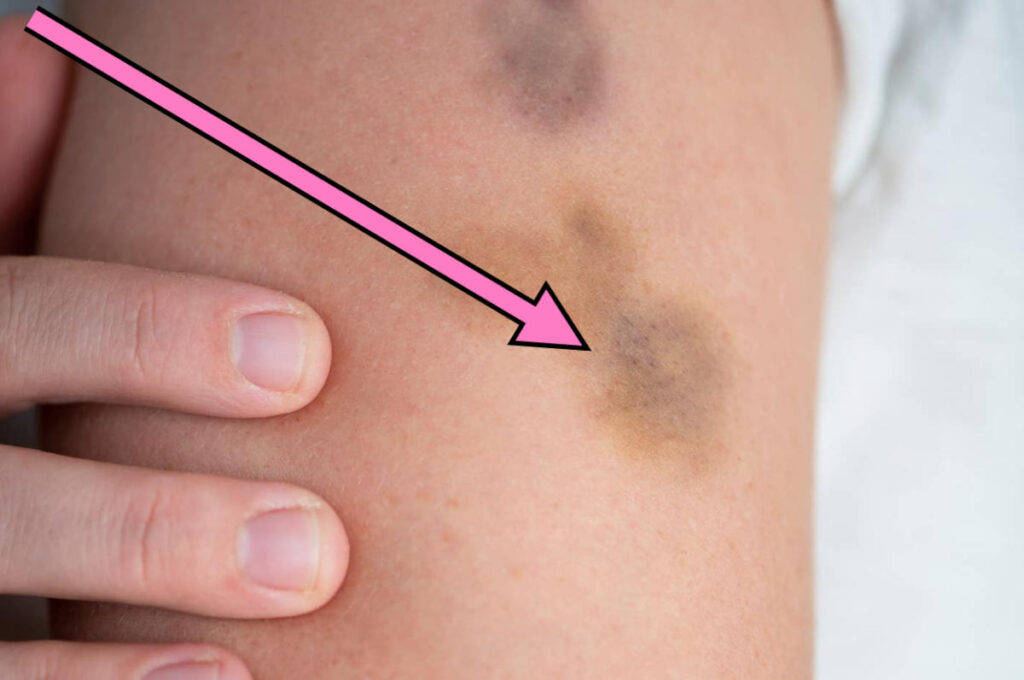 People Are Sharing The Wildest Medical Self-Diagnoses That Actually Turned Out To Be Correct