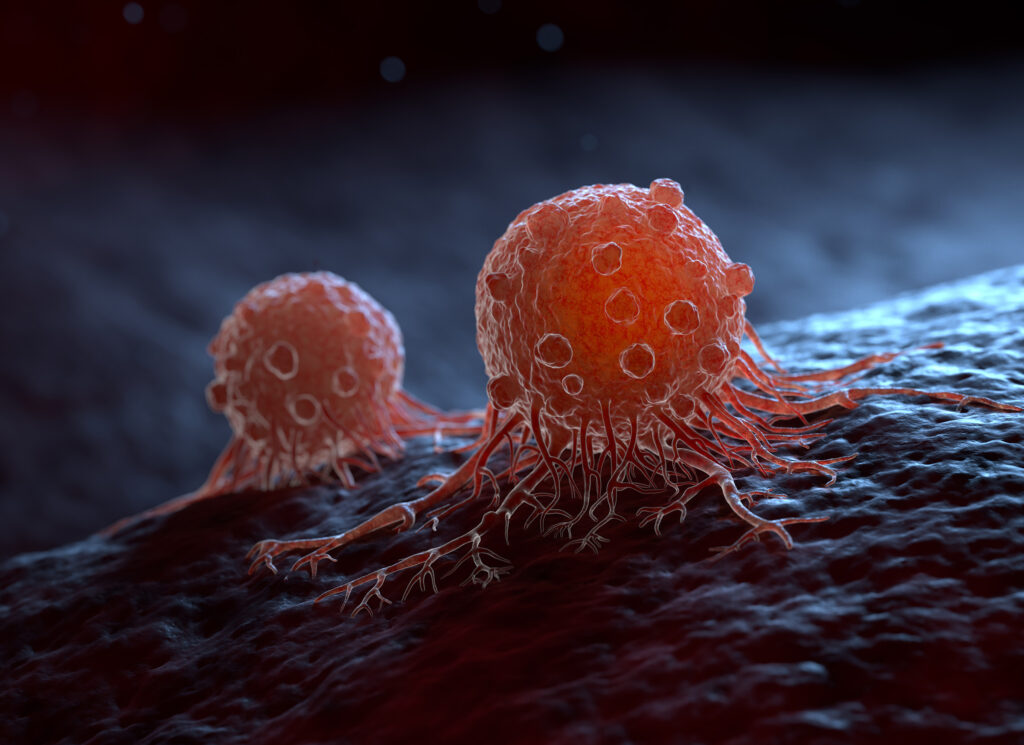 New study could completely change how we diagnose cancer patients